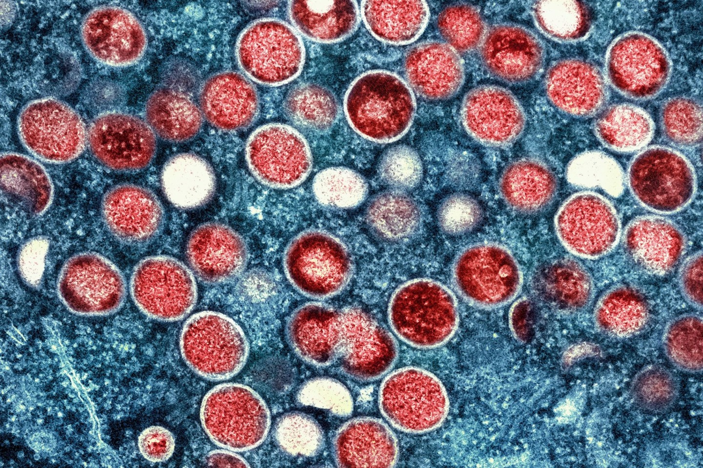 Eine eingefärbte Mikroskopaufnahme von Mpox-Partikeln (rot) in einer infizierten Zelle (blau), die im Labor kultiviert wurde.