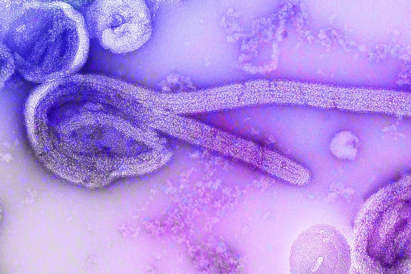 Eine elektronenmikroskopische Aufnahme des Marburgvirus. Im zentralafrikanischen Äquatorialguinea ist der Ausbruch des lebensgefährlichen Marburg-Fiebers bestätigt worden. (Bild von 1968)